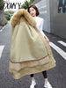 imCharms Autumn And Winter Down Jacket Temperament Self-Cultivation Large Size Liner Detachable Jacket Long Women